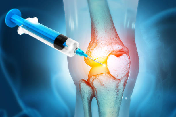 Regenerative Medicine Might Fix Knee Pain Issues – The Promise That Stem Cell Therapy Brings In 